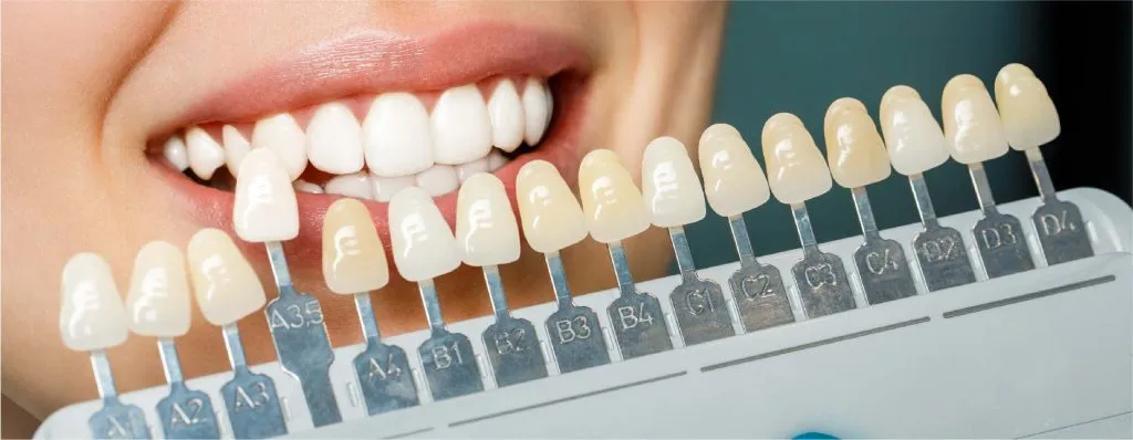 Smiling person showing teeth shade guide for dental matching.