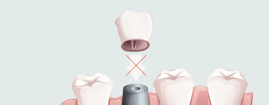 ill-fitting-crown.webp