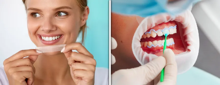 teeth-whitening-products.webp