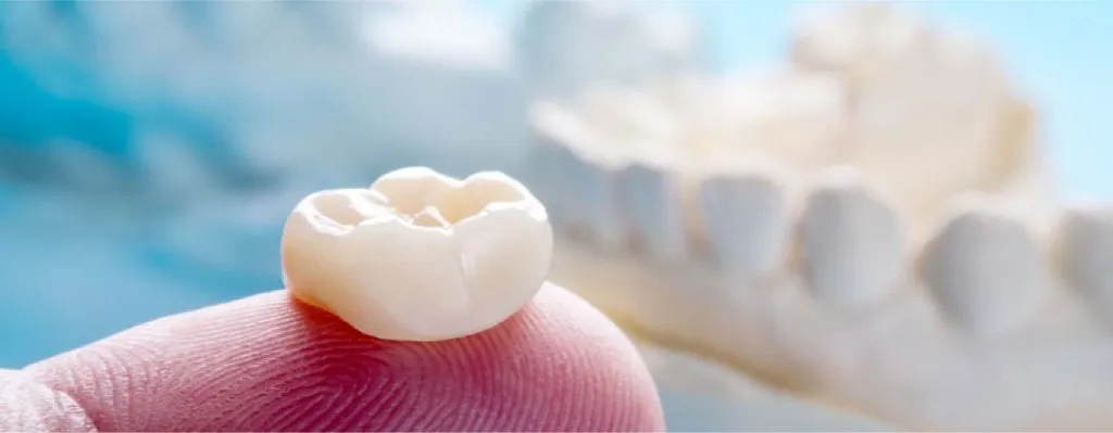 Dental crown on a fingertip with a blurred dental model in background.