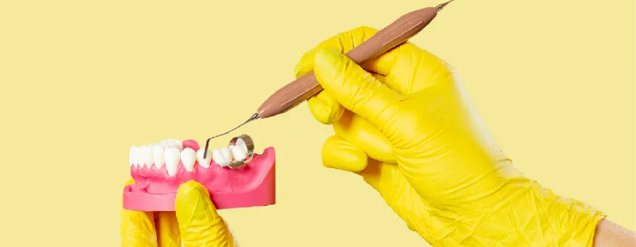 yellowing-of-the-teeth-may-be-a-sign-of-weakened-enamel.webp