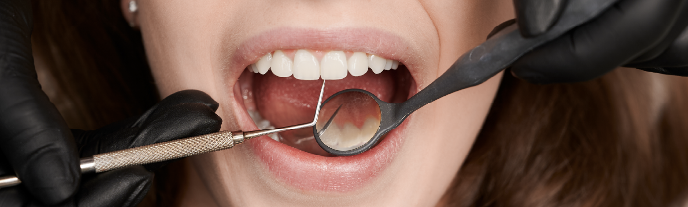 In Which Situations Should a Tooth Not Be Extracted?