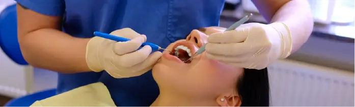 When Should a Dental Filling Be Replaced?