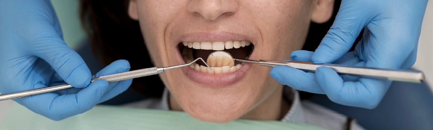 Kuafaj Tedavisi Nedir? Kuafaj Dolgu Nasıl Yapılır? 