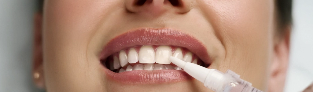 Diş Beyazlatma Kalemi Nedir, Ne İşe Yarar, Nasıl Kullanılır?