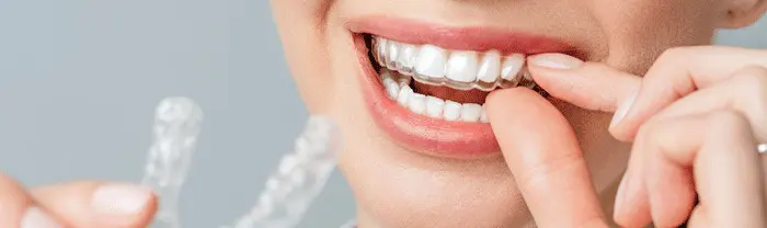 Damaklık Nedir, Hangi Durumlarda Kullanılır?