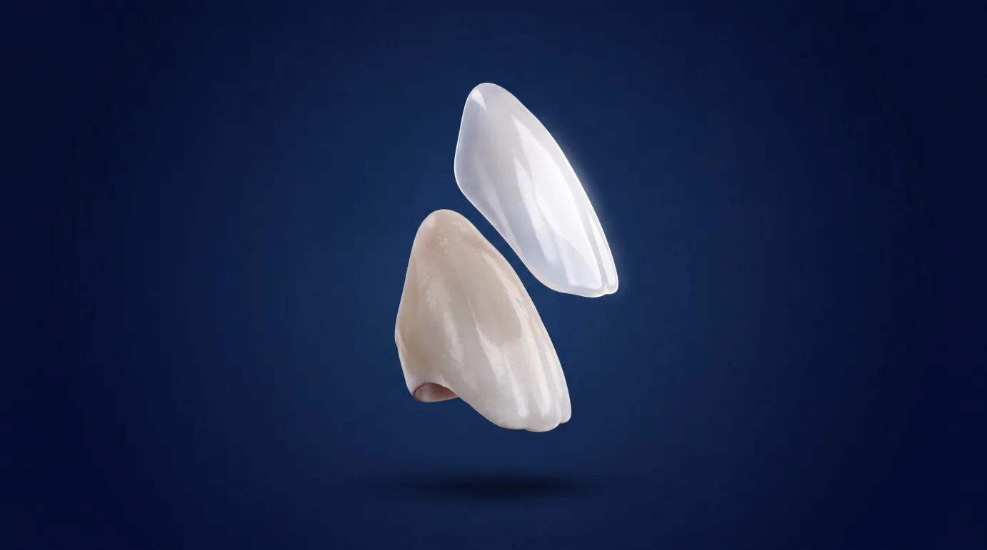 Veneers & Bonding