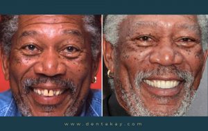 Morgan Freeman 