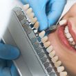 How Much Does It Cost to Get Veneers?