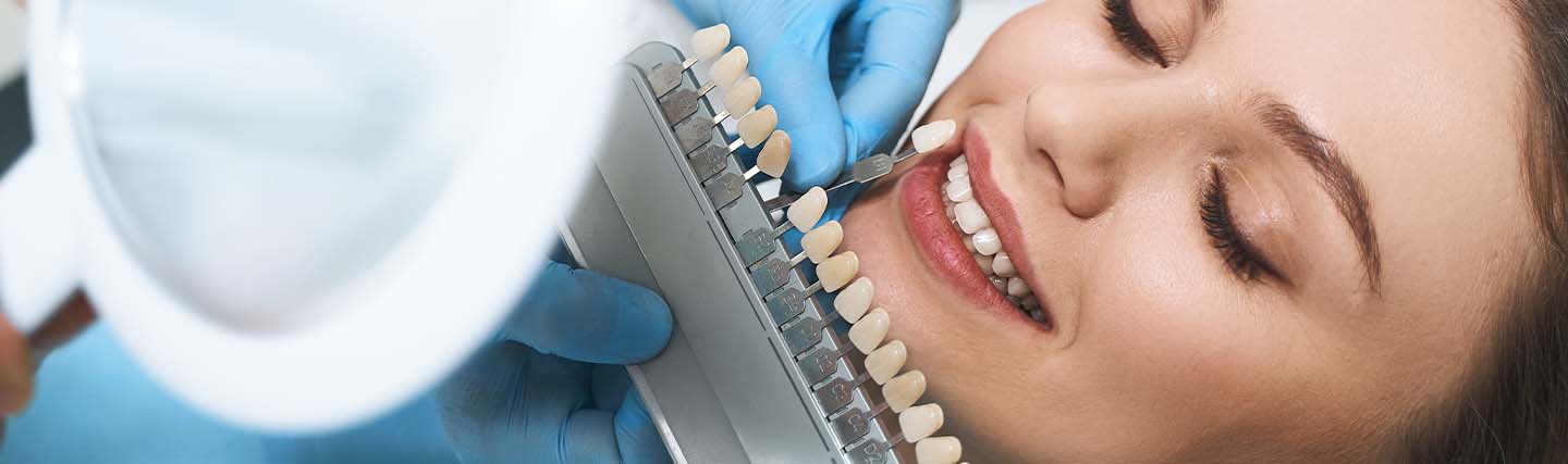 dental Veneers cost