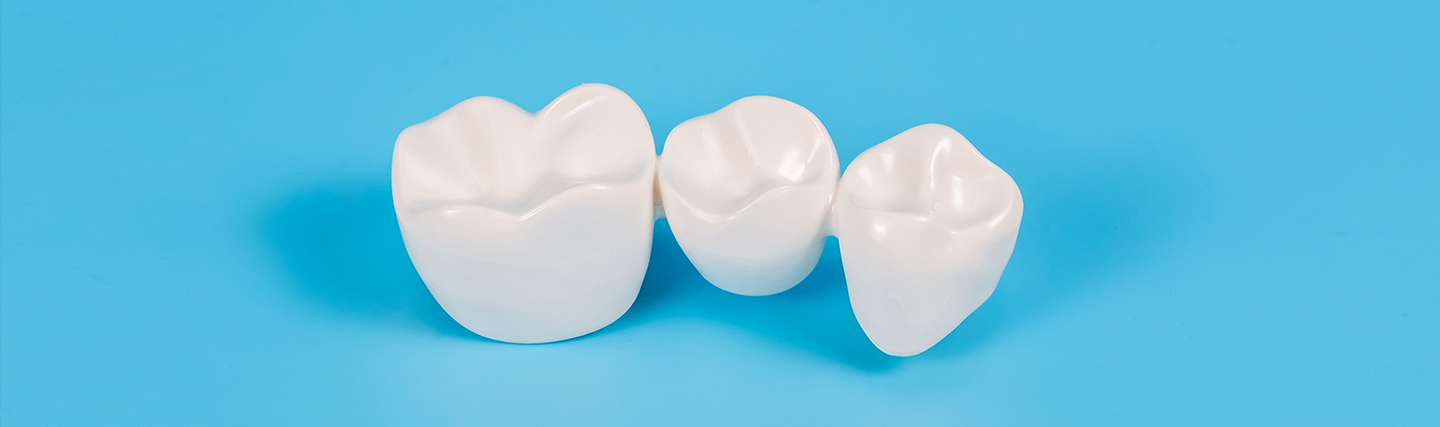 Dental crowns Cost