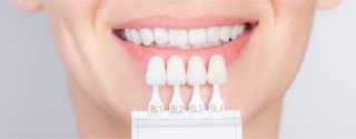 What is a tooth veneer