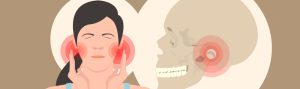 TMJ disorder caused by bruxism