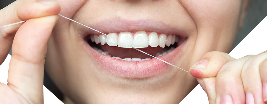 Brush and floss regularly to remove dental calculus