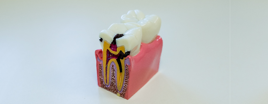 tooth nerve may damage during the dental crown procedure 