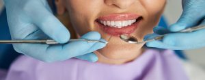 Diagnose und Behandlung von weißem Zahnfleisch