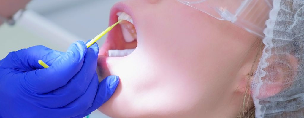 Tratamiento con flúor para manchas blancas en los dientes