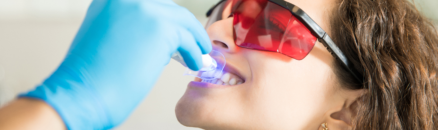 Ist die Zahnaufhellung mit Laser sicher ? Dentakay