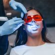 Teeth whitening for sensitive teeth - Dentakay